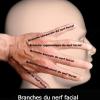 Branches du nerf facial (schéma)