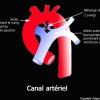 Canal artériel (schéma)