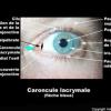 Caroncule lacrymale
