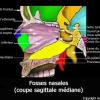 Fosses nasales : coupe sagittale médiane (schéma)