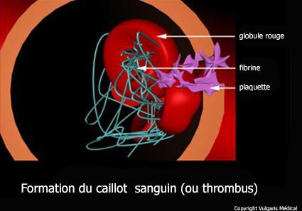 Formation du thrombus (caillot sanguin) - schéma