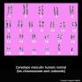 Caryotype (chromosomes ordonnés)