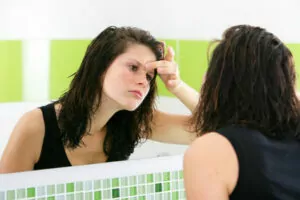 7 astuces naturelles contre l'acné