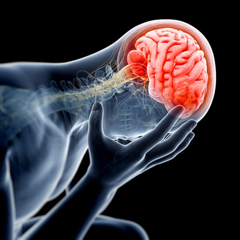 Alzheimer