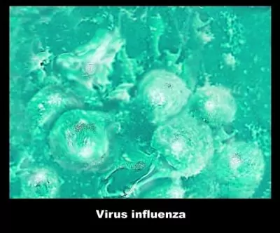 Quelle est la gravité de la grippe h1 n1?