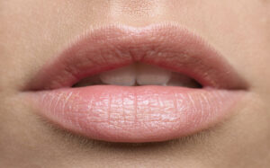 Lèvres gercées : 6 remèdes simples et naturels pour les soigner