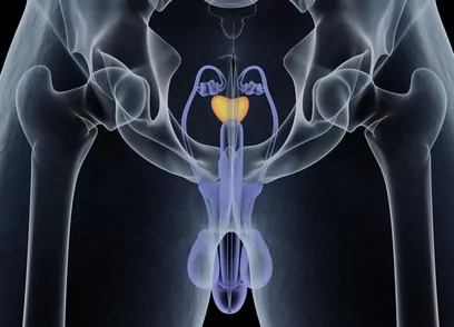 Cancer de la prostate : Dépistage, Symptômes, Traitements, Prévention