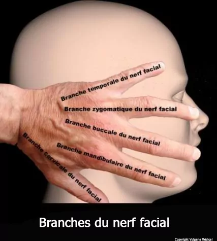 Branches du nerf facial (schéma)