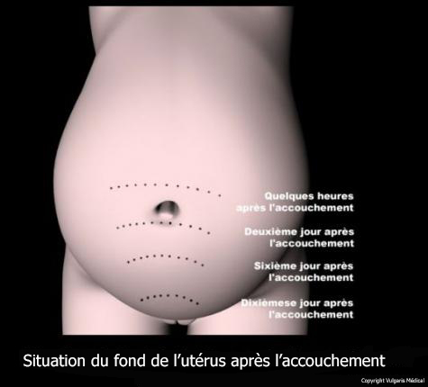 Position du fond de l'utérus après l'accouchement (schéma)