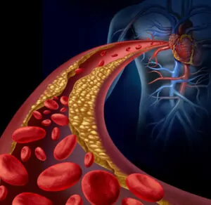 Cholestérol : conseils diététiques pour réduire l'hypercholestérolémie