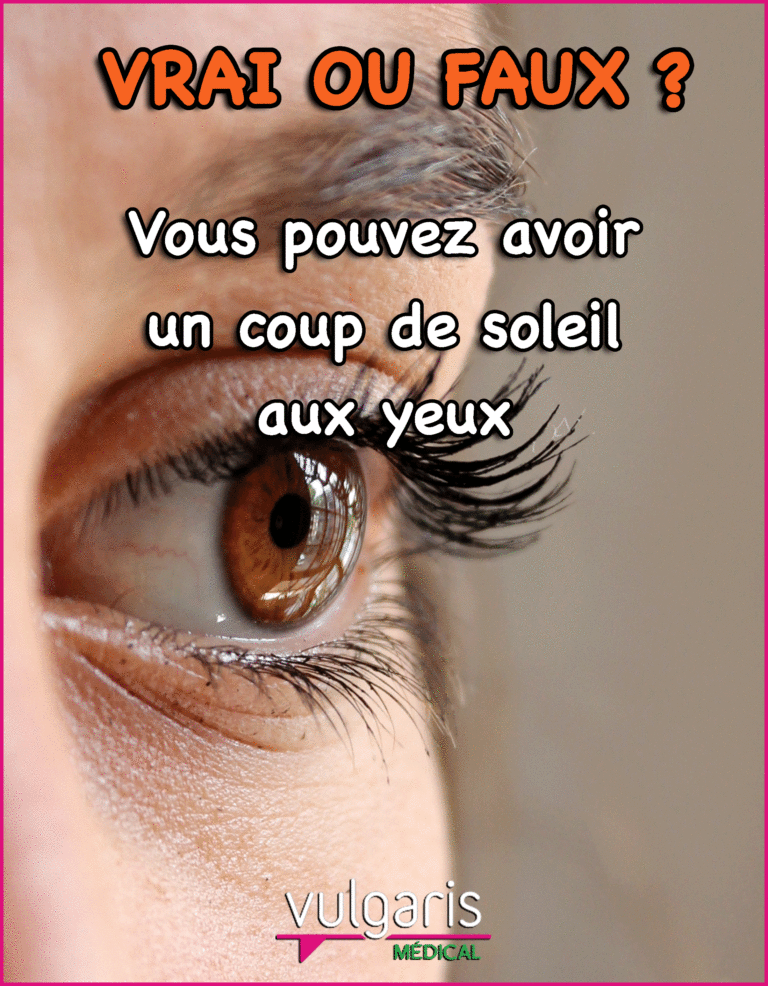 [VRAI OU FAUX ?] On peut avoir un coup de soleil aux yeux !
