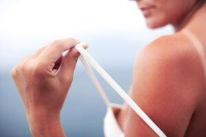 Cancer de la peau : 5 coups de soleil peuvent suffire