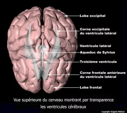 Localisation des ventricules cérébraux vus de dessus (schéma)