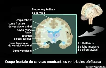 Ventricules cérébraux : disposition dans le cerveau (schéma)