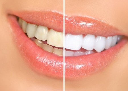 4 dentifrices naturels pour des dents plus blanches