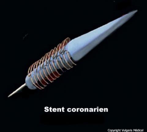 Stent coronarien