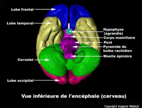 Cerveau (vue inférieure)