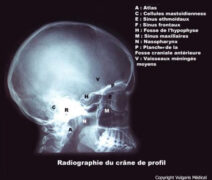 cr-ne-radiographie-de-profil-anatomie-photo-et-illustration