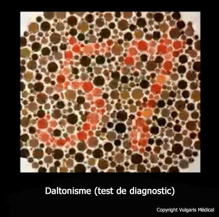 Daltonisme (test)