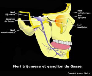 Nerf trijumeau et ganglion de Gasser - Anatomie, photo et illustration