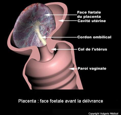 Placenta : face fœtale lors de la délivrance (schéma)