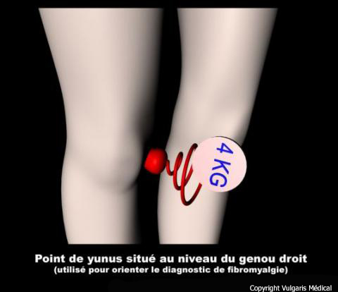 Point de yunus situé au niveau du genou droit
