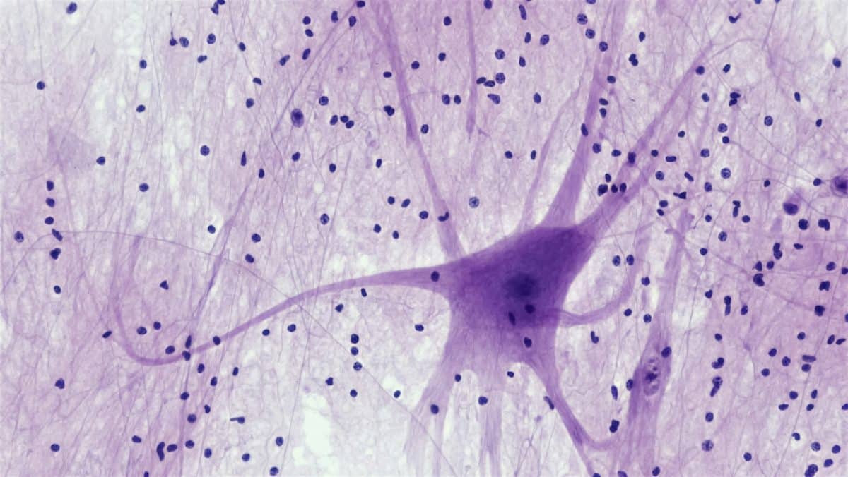 Microphotographie montrant un neurone avec ses extensions au milieu d’un réseau cellulaire, coloré en violet.
